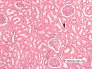 Normal kidney